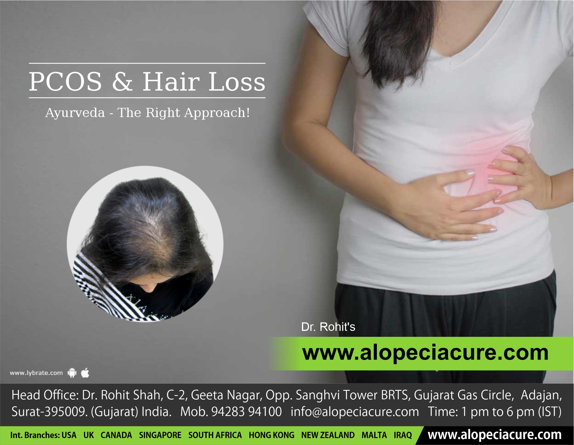 PCOS (PCOD) related hair loss