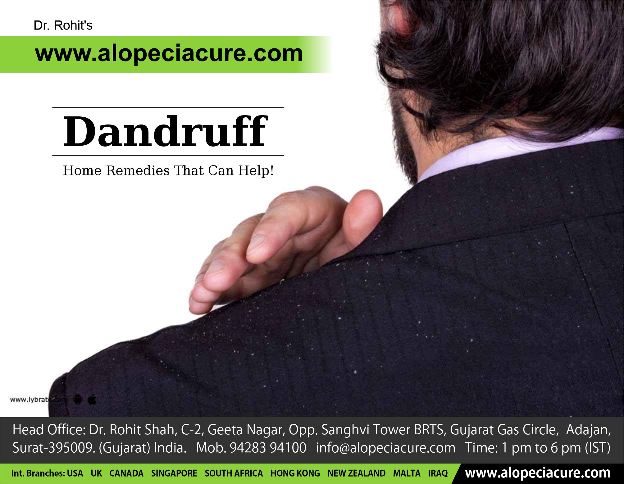 Dandruff - 5 Home Remedies That Can Help!