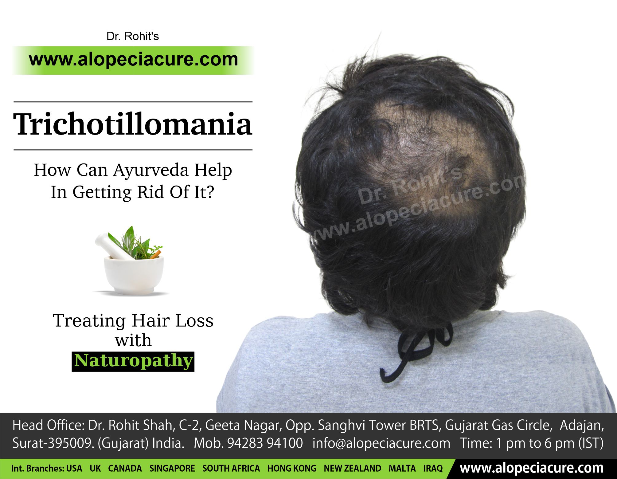 Trichotillomania - How Can Ayurveda Help In Getting Rid Of It?