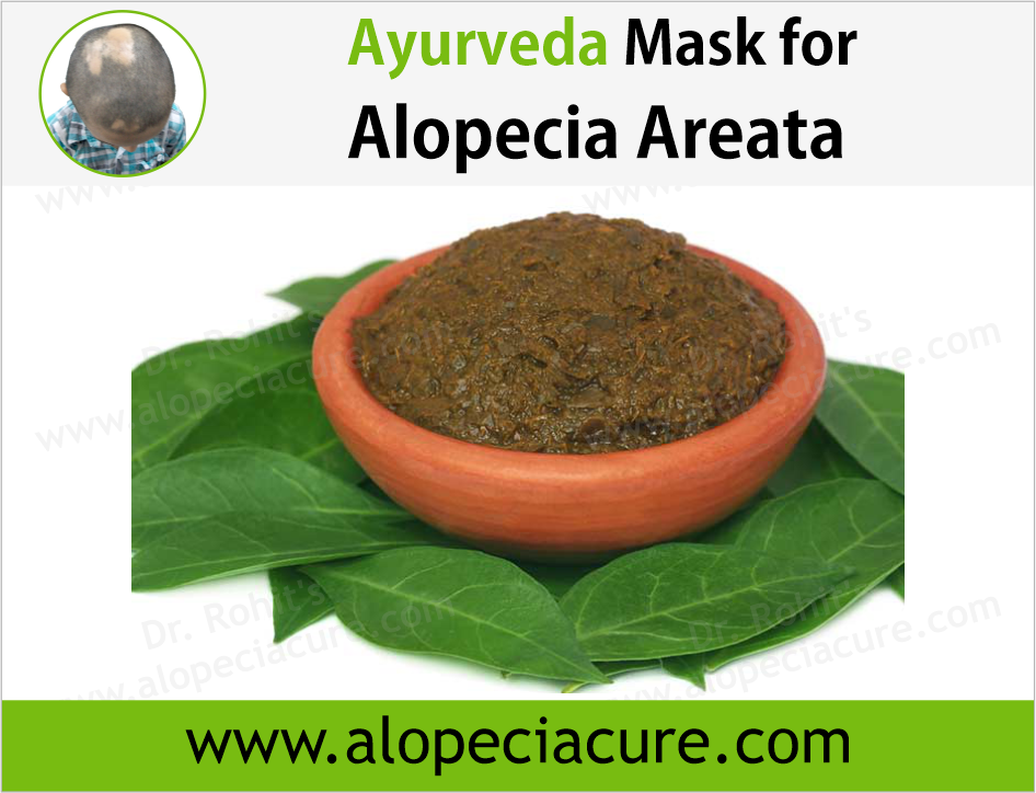 Dr. Rohit's natural mask treatment of alopecia areata