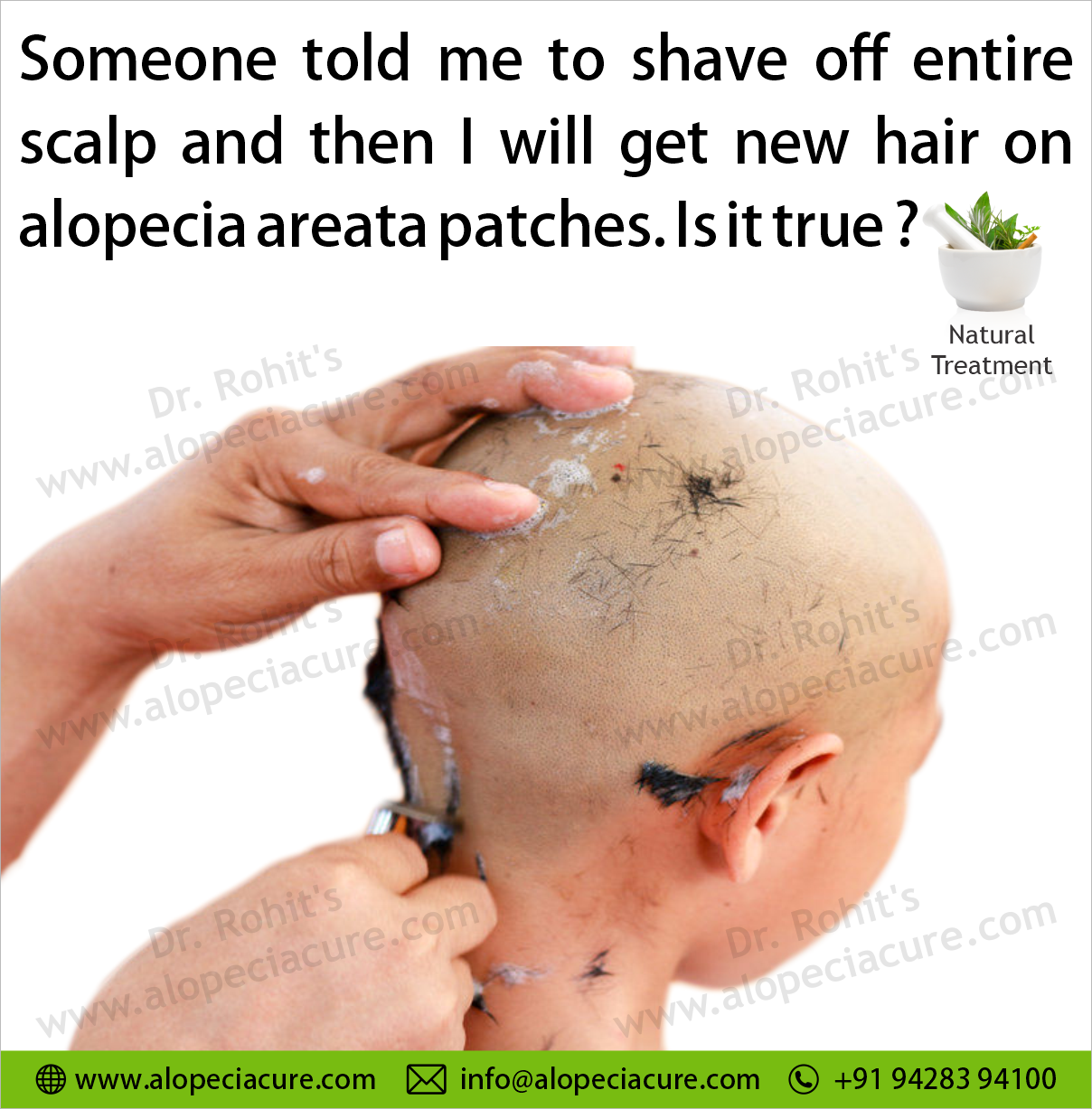 Someone told me to shave off entire scalp and then i will get new hair on alopecia areata patches. Is it true ?