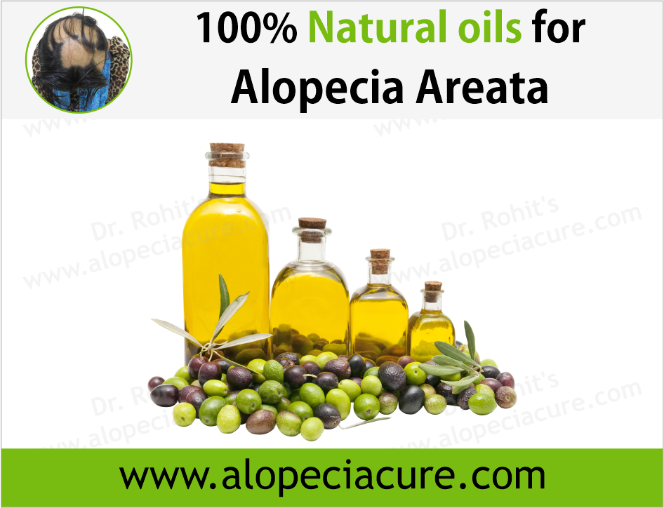 Dr. Rohit's natural oil treatment for  alopecia areata