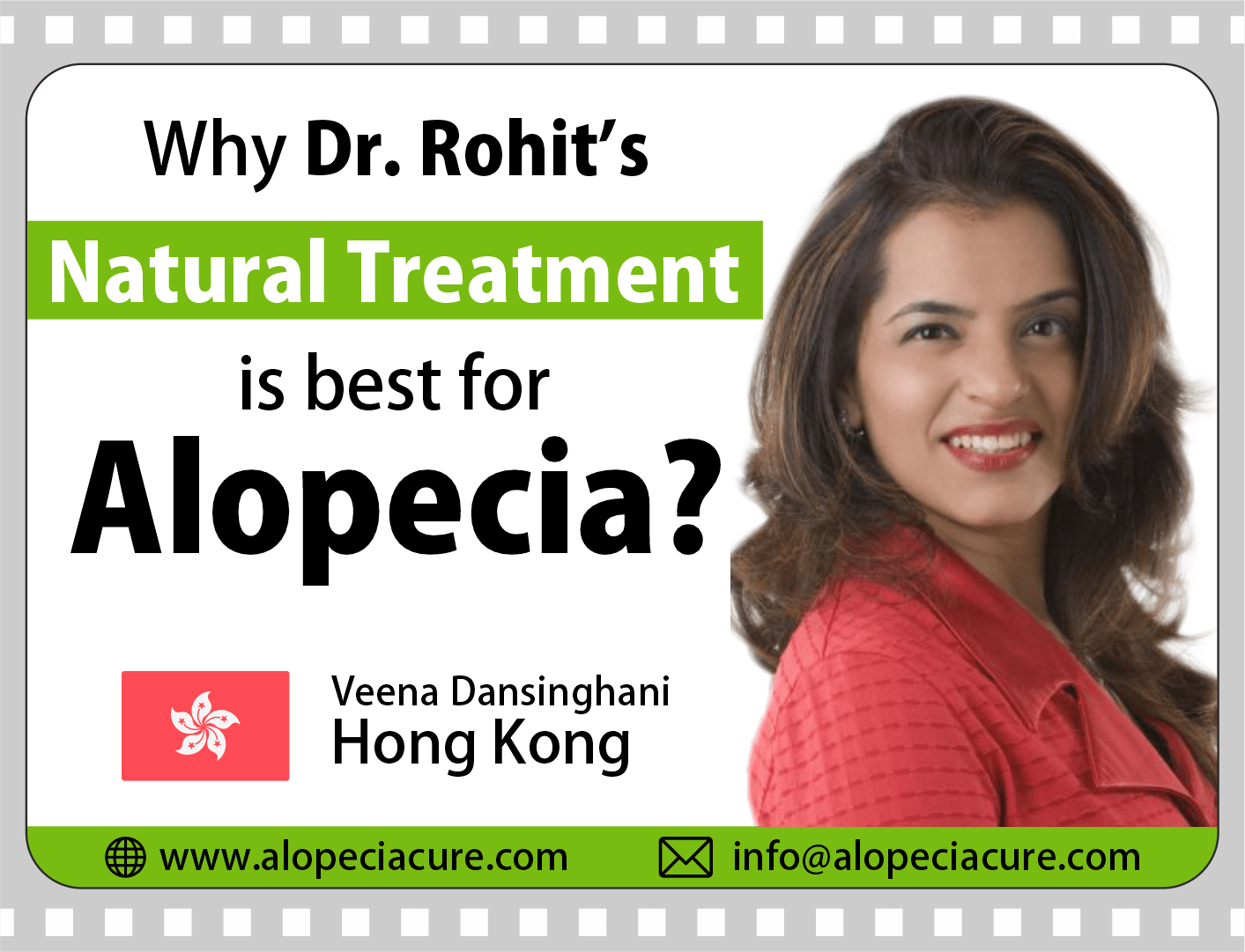 HongKong patient review for Dr. Rohit's natural treatment for alopecia totalis
