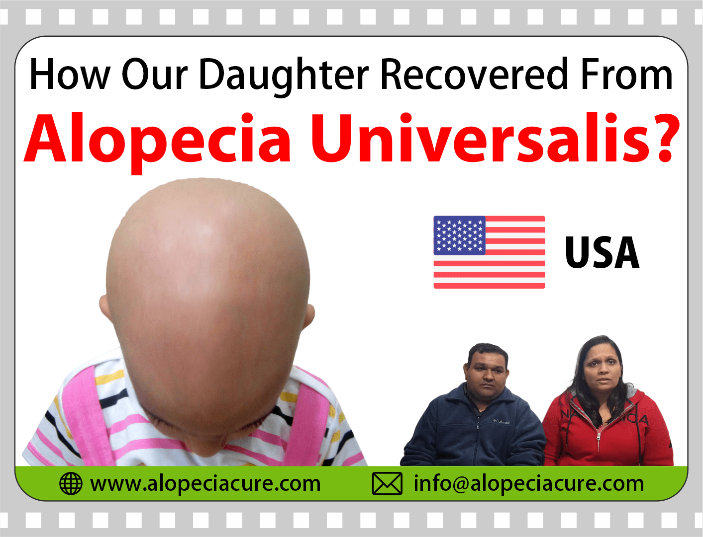 USA patient review for Dr. Rohit's natural treatment for alopecia areata