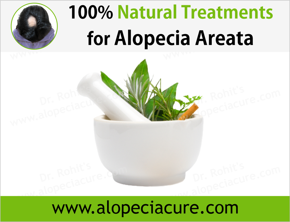 Dr Rohits natural treatment for alopecia areata