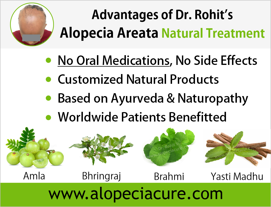 Advantages of Dr. Rohit's natual treatment for alopecia areata - Based on Ayurveda & Naturopathy - Customized Natural Treatments - No oral pills, No chemicals - Worldwide Patients Benifited