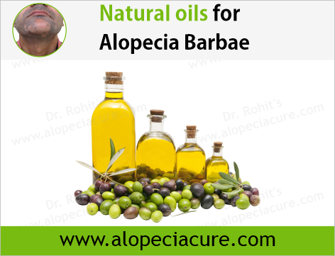 Dr. Rohit's natural oil treatment for  alopecia areata
