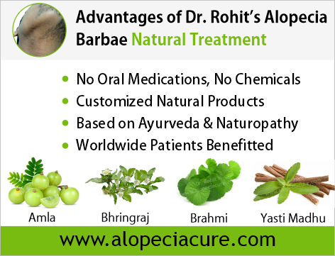 Advantages of Dr. Rohit's natual treatment for alopecia areata - Based on Ayurveda & Naturopathy - Customized Natural Treatments - No oral pills, No chemicals - Worldwide Patients Benifited