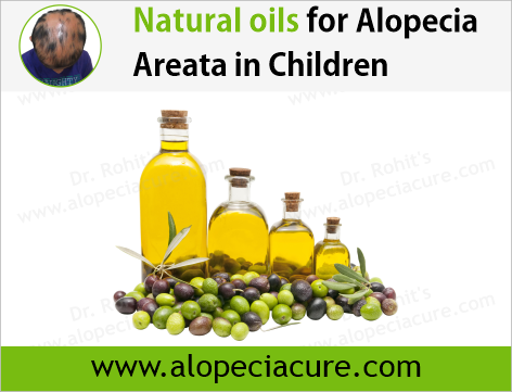 Dr. Rohit's natural oil treatment for  alopecia areata