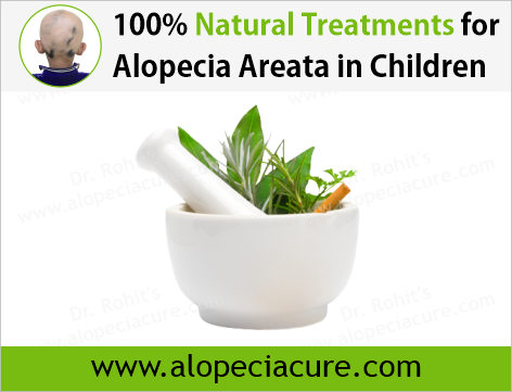 Dr Rohits natural treatment for alopecia areata