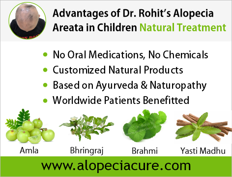 Advantages of Dr. Rohit's natual treatment for alopecia areata - Based on Ayurveda & Naturopathy - Customized Natural Treatments - No oral pills, No chemicals - Worldwide Patients Benifited