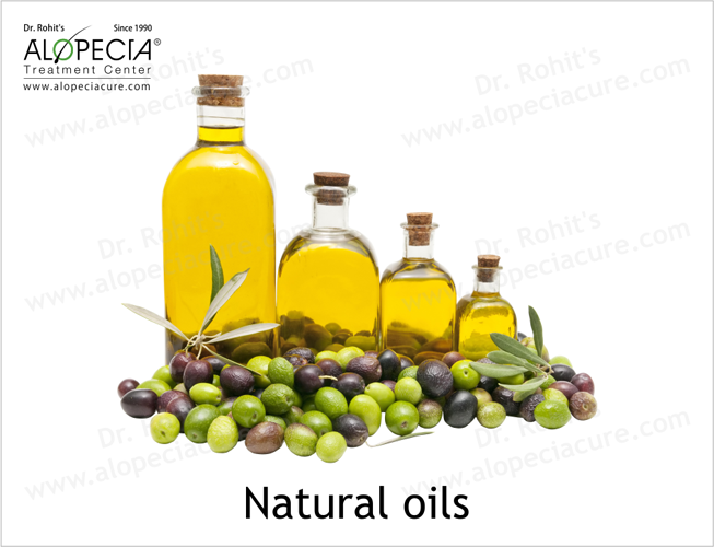 Dr. Rohit's natural oil treatment for  alopecia areata