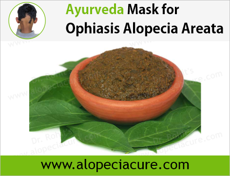 Dr. Rohit's natural mask treatment of alopecia areata