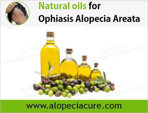 Dr. Rohit's natural oil treatment for  alopecia areata