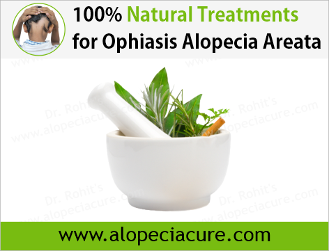 Dr Rohits natural treatment for alopecia areata