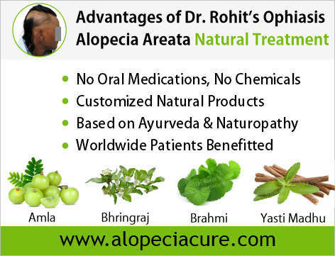 Advantages of Dr. Rohit's natual treatment for alopecia areata - Based on Ayurveda & Naturopathy - Customized Natural Treatments - No oral pills, No chemicals - Worldwide Patients Benifited