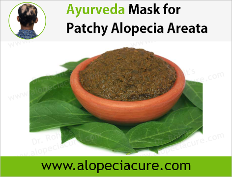 Dr. Rohit's natural mask treatment of alopecia areata