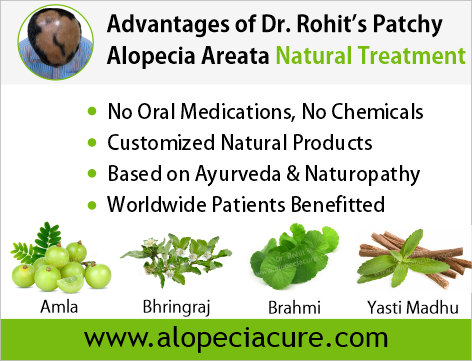 Advantages of Dr. Rohit's natual treatment for alopecia areata - Based on Ayurveda & Naturopathy - Customized Natural Treatments - No oral pills, No chemicals - Worldwide Patients Benifited