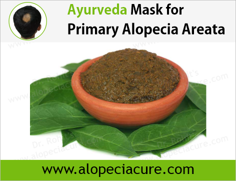 Dr. Rohit's natural mask treatment of alopecia areata