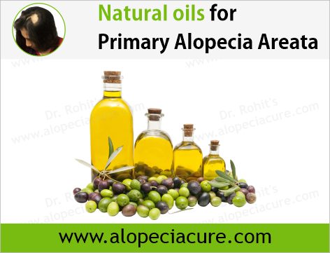 Dr. Rohit's natural oil treatment for  alopecia areata