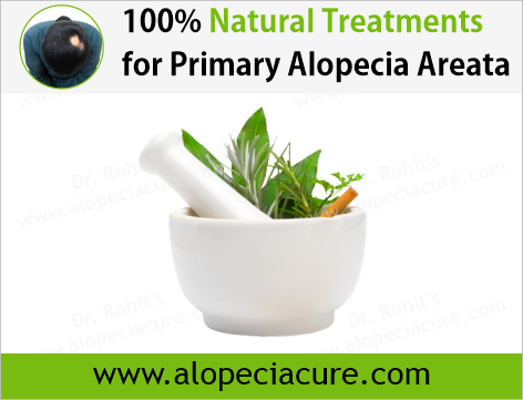 Dr Rohits natural treatment for alopecia areata