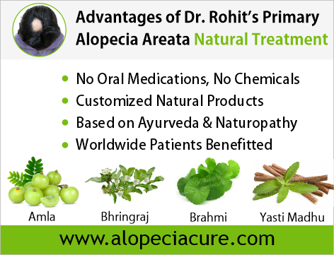 Advantages of Dr. Rohit's natual treatment for alopecia areata - Based on Ayurveda & Naturopathy - Customized Natural Treatments - No oral pills, No chemicals - Worldwide Patients Benifited