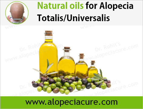 Dr. Rohit's natural oil treatment for  alopecia totalis