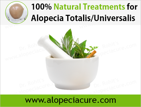 Dr Rohits natural treatment for alopecia totalis