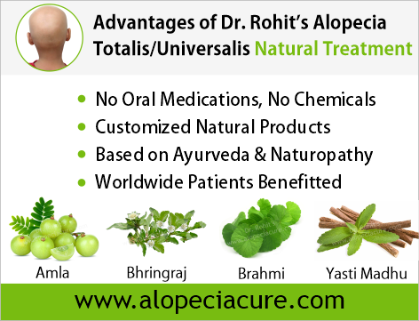 Advantages of Dr. Rohit's natual treatment for alopecia totalis - Based on Ayurveda & Naturopathy - Customized Natural Treatments - No oral pills, No chemicals - Worldwide Patients Benifited