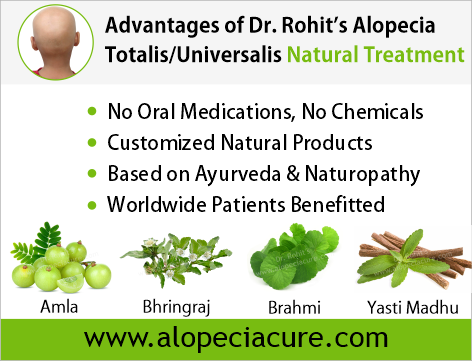 Advantages of Dr. Rohit's natual treatment for alopecia areata - Based on Ayurveda & Naturopathy - Customized Natural Treatments - No oral pills, No chemicals - Worldwide Patients Benifited