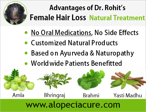 female hair loss treatment