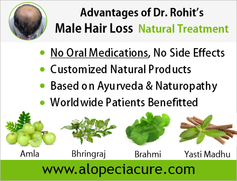 male hair loss treatment