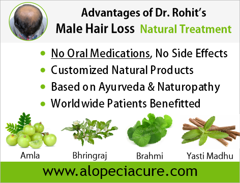 Advantages of Dr. Rohit's natual treatment for male hair loss - Based on Ayurveda & Naturopathy - Customized Natural Treatments - No oral pills, No chemicals - Worldwide Patients Benifited