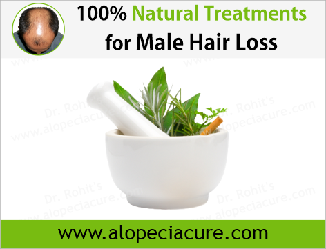 Dr Rohits natural treatment for male hair loss