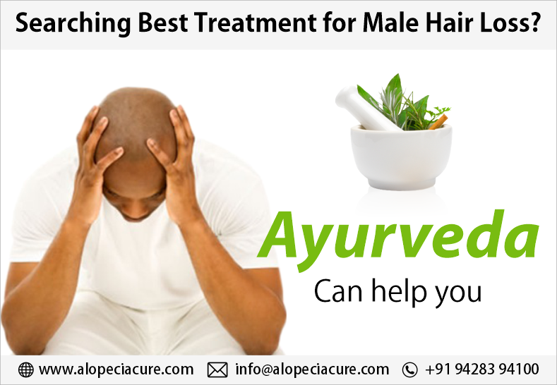 male hair loss treatment