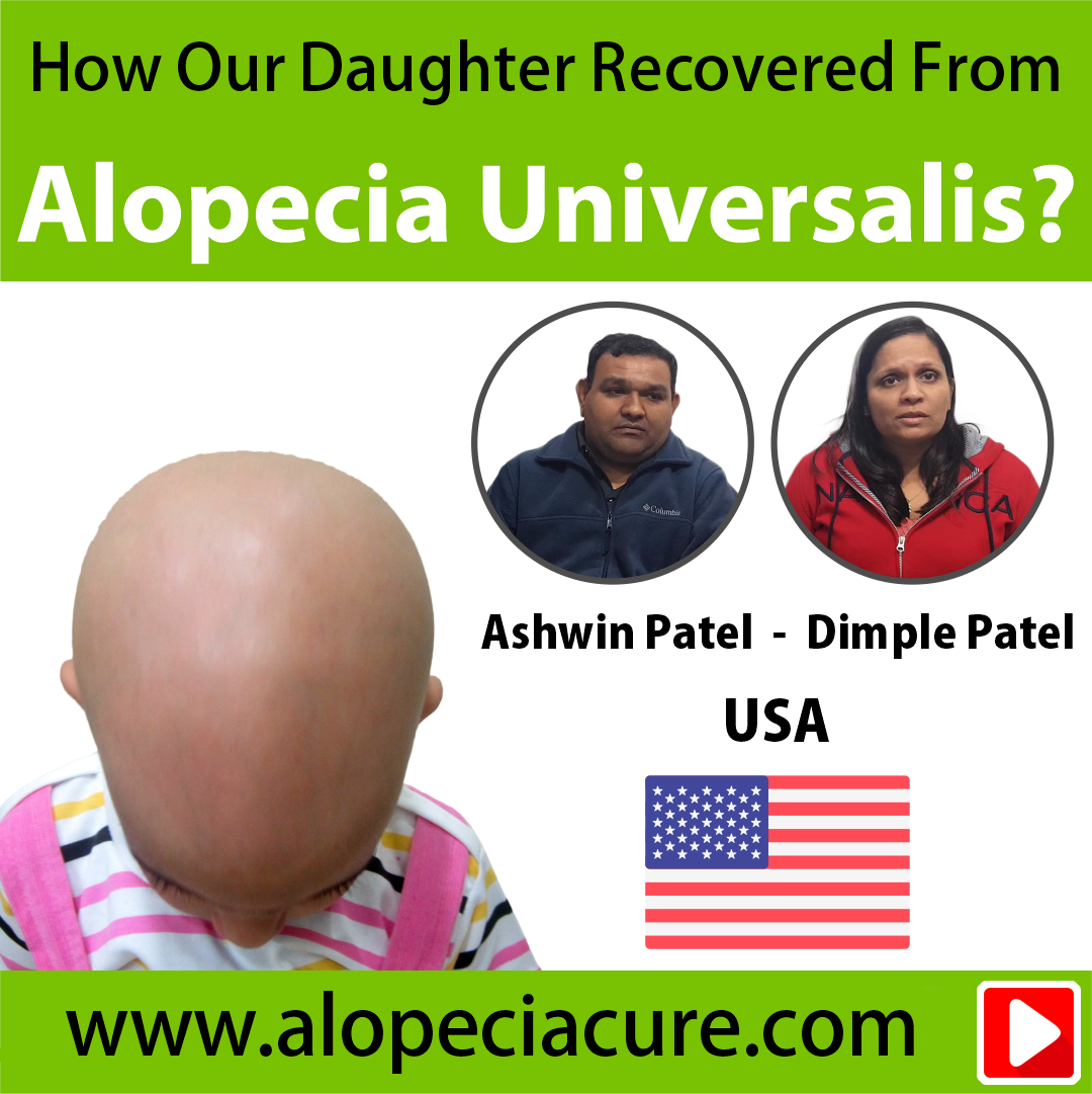 children alopecia treatment