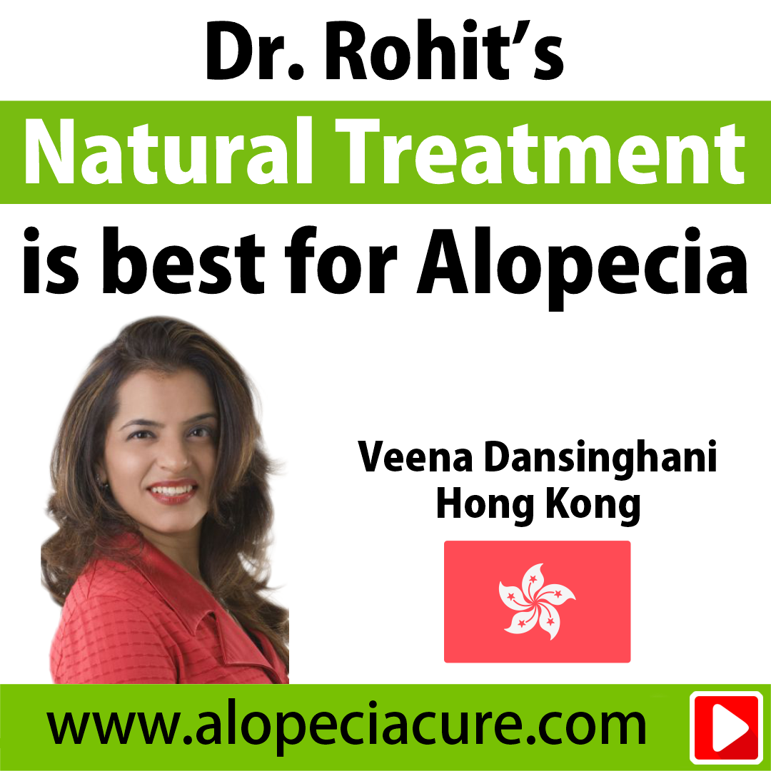 alopecia areata treatment review