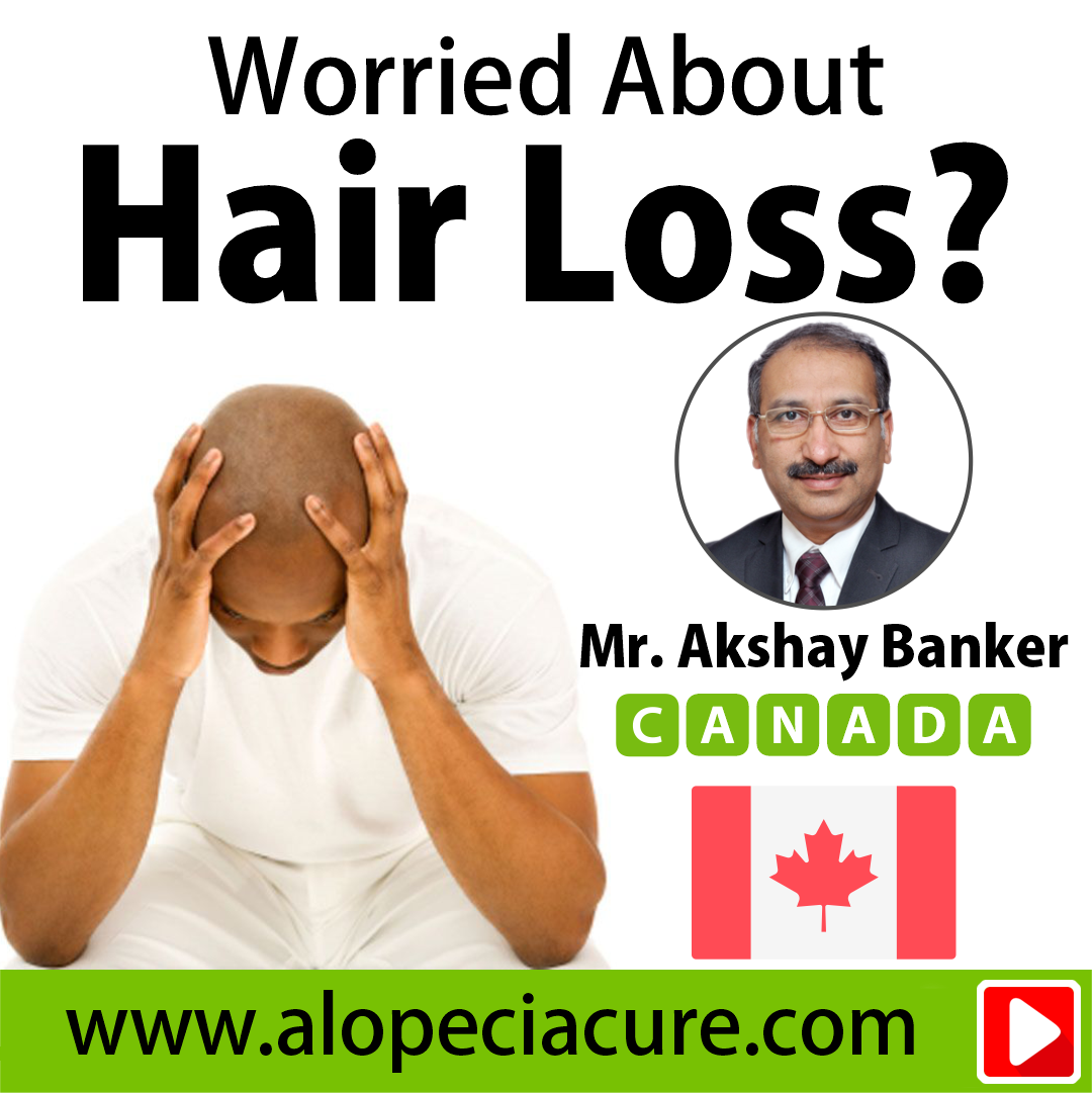 hair loss treatment