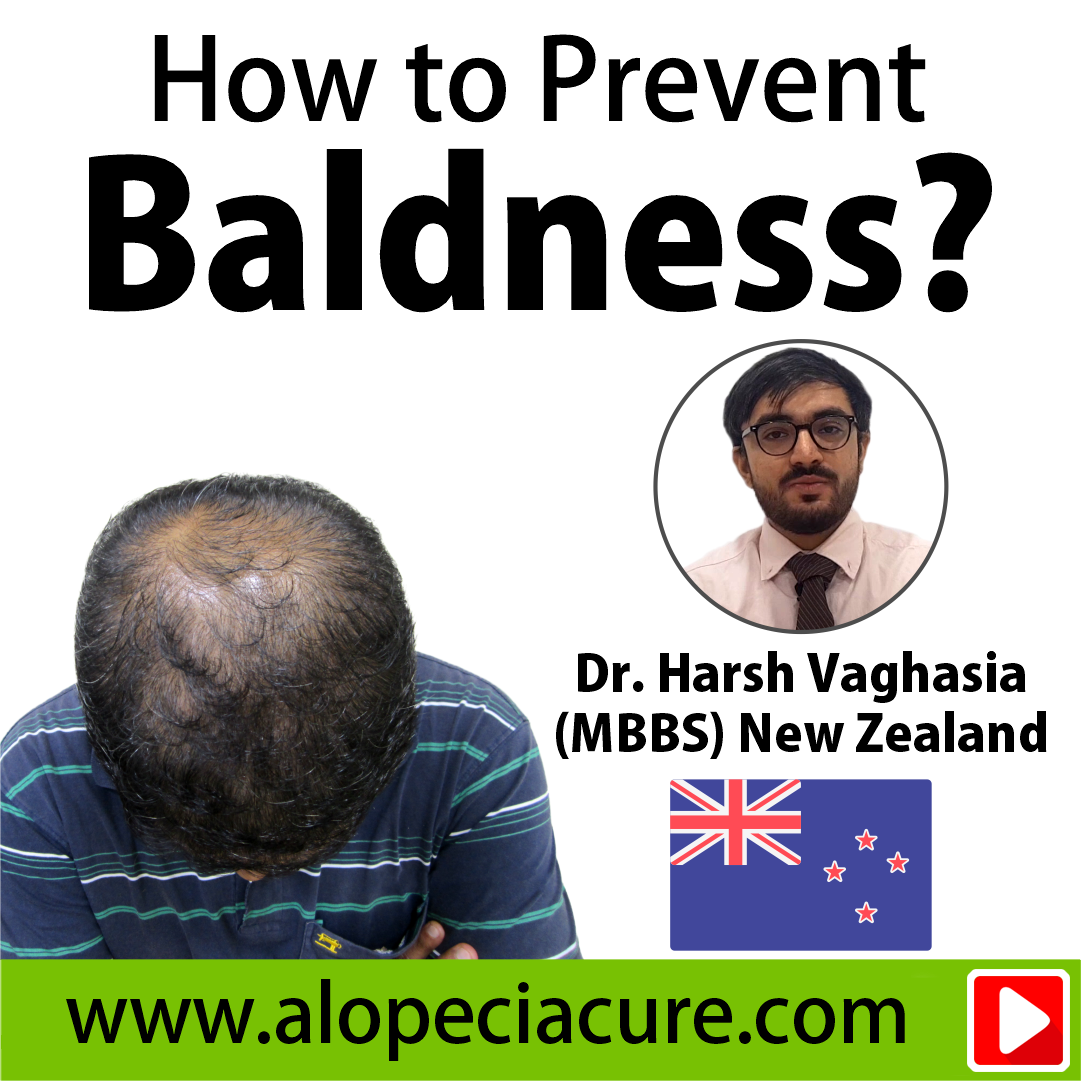 male hair loss treatment