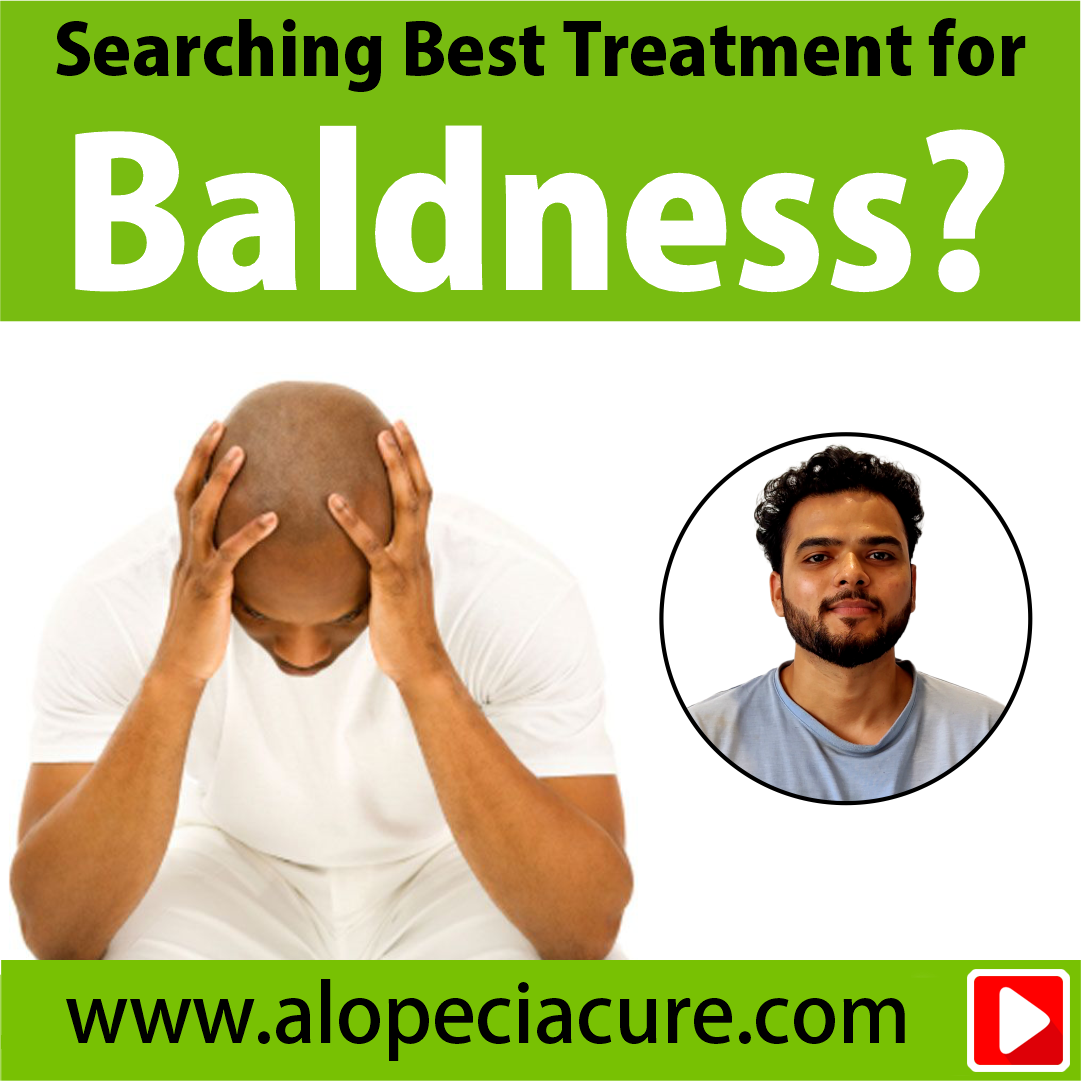 baldness treatment