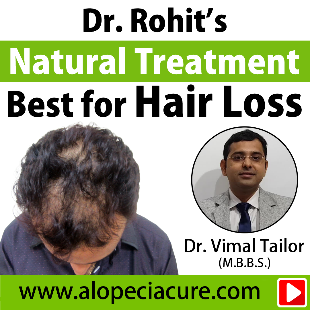 hair fall treatment