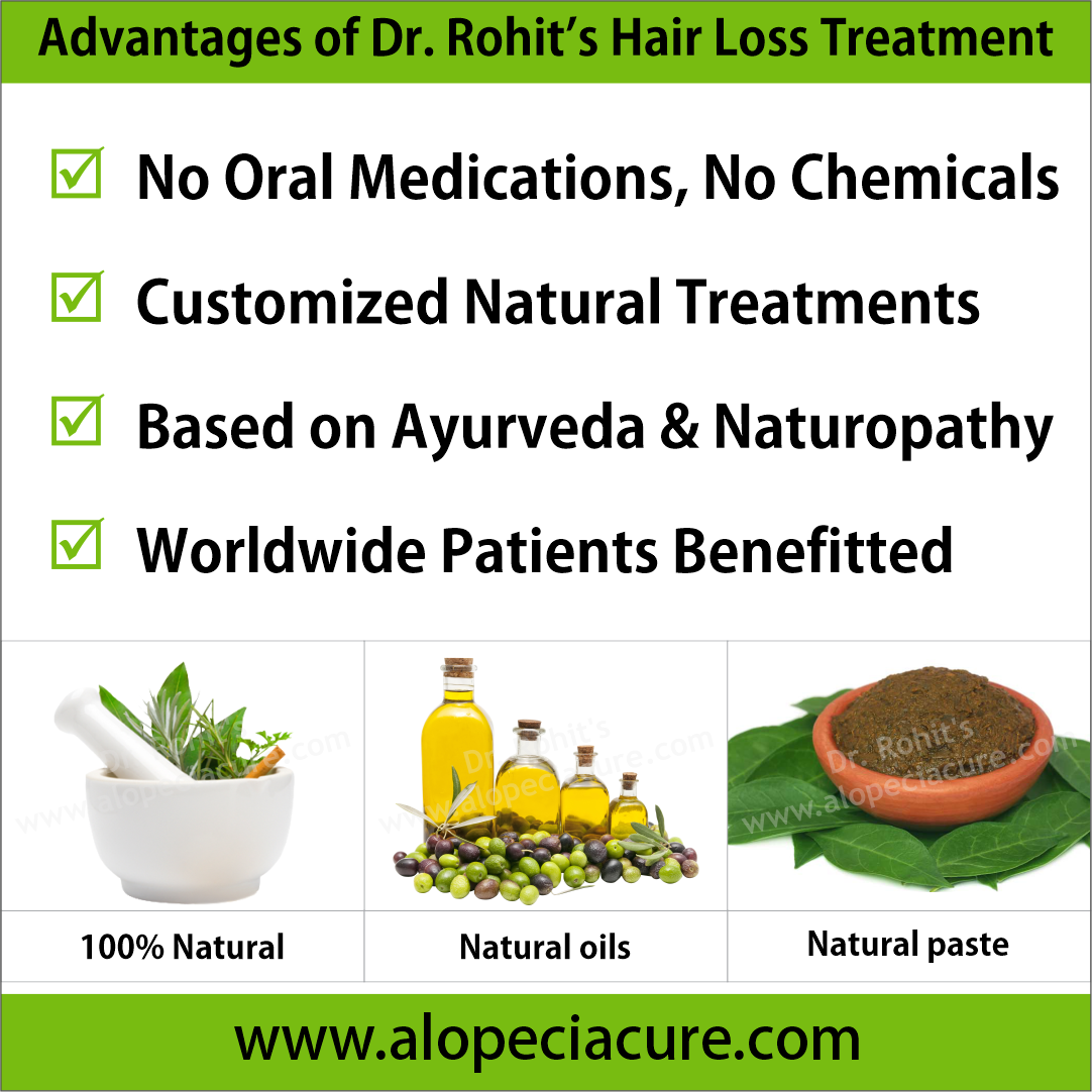 ophiasis alopecia areata treatment