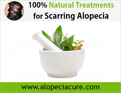 Dr Rohits natural treatment for scarring alopecia