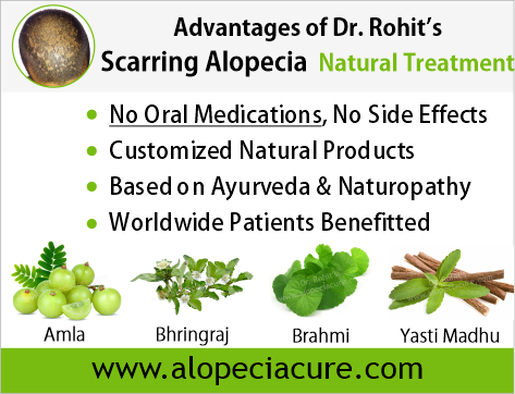 Dr Rohits natural treatment for scarring alopecia