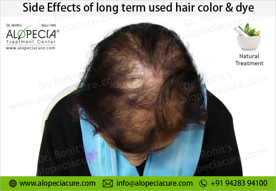 Side Effects of Chemical Beauty Treatments