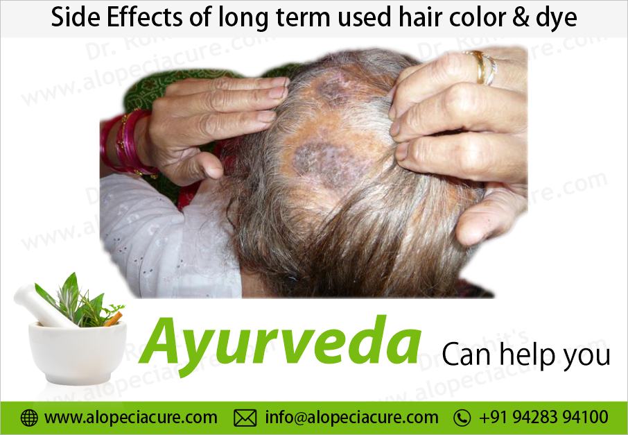 Side Effects of Chemical Beauty Treatments
