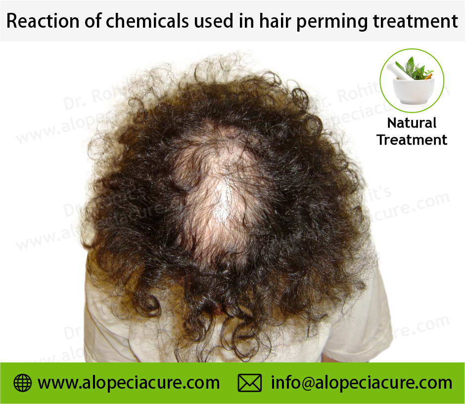 Side Effects of Chemical Beauty Treatments