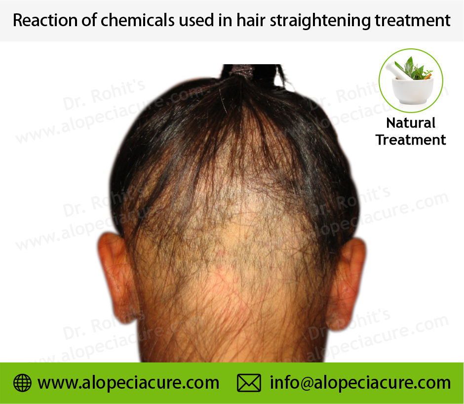 Side Effects of Chemical Beauty Treatments