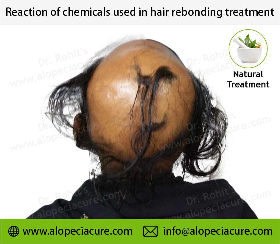 Side Effects of Chemical Beauty Treatments