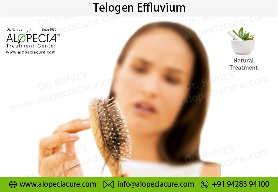 telogen effluvium